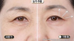 ลืมงานโบท็อกซ์ไปได้เลย Lifting Stick ปาดหน้า 3 ที รู้เรื่อง ตึงทันตา อุ๊ต๊ะ!!!