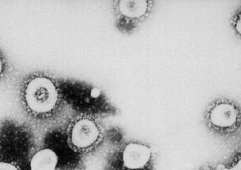 ยืนยันแล้ว ! ญี่ปุ่นพบผู้ติดเชื้อไวรัสโคโรนา 1 ราย