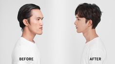 พลิกความฝัน เอ็กซ์ นพจิต Let me in Thailand season 3 หลังศัลยกรรมขากรรไกร