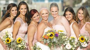 Kylie Bamberger เจ้าสาวหัวล้าน สุดสตรอง ขอสวยแบบไม่ใส่วิก ในวันแต่งงาน