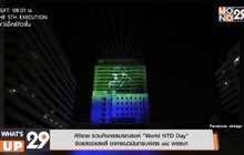 ศิริราช ร่วมกิจกรรมรณรงค์ “World NTD Day” จัดแสดงแสงสี อาคารนวมินทรบพิตร 84 พรรษา