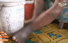 วอนช่วยชายชราอายุกว่า 100 ปีป่วยเบาหวานขาเน่า