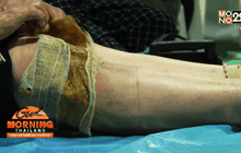 ยาพอกดูดพิษบรรเทาอาการปวดข้อ