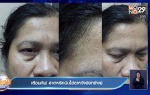 เตือนภัย! สาดพริกป่นใส่ตาหวังชิงทรัพย์