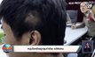 หนุ่มโชคร้ายถูกรุมทำร้าย แต่ผิดคน