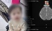 แห่ส่งกำลังใจ! แม่โพสต์ลูกวัย 2 ขวบ ป่วยโรคหายาก – ค่ารักษา 140 ล้าน