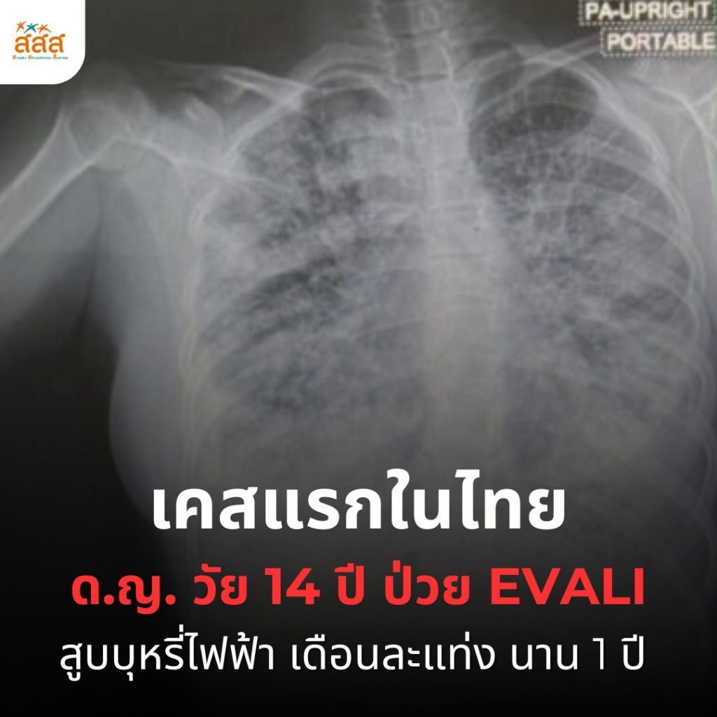 บุหรี่ไฟฟ้า