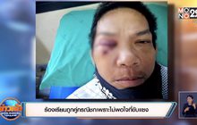 ร้องเรียนถูกคู่กรณีชกเพราะไม่พอใจที่ขับแซง