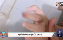 ครูพี่เลี้ยงปิดประตูทับนิ้ว นร.ขาด