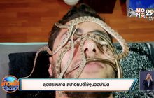 สุดประหลาด สปาอียิปต์ใช้งูนวดบำบัด