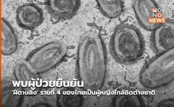 พบผู้ป่วยยืนยัน ‘ฝีดาษลิง’ รายที่ 4 ของไทยเป็นผู้หญิงใกล้ชิดต่างชาติ