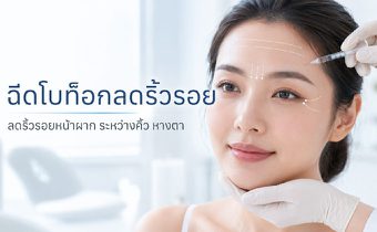 รู้จักฉีดโบลดริ้วรอย ผลลัพธ์ ข้อดี ข้อจำกัด และราคาแต่ละตำแหน่ง