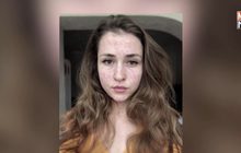 ชาวยูเครนไม่เชื่อมั่นวัคซีนป้องกันโรคหัด