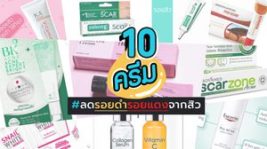 10 ครีม-เจล ลดรอยดำจากสิว โชว์หน้าใสไม่ต้องง้อคอนซีลเลอร์
