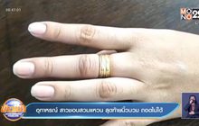 อุทาหรณ์ สาวชอบสวมแหวน สุดท้ายนิ้วบวม ถอดไม่ได้
