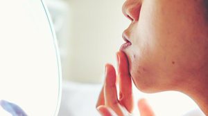 สิวขึ้น ผดขึ้น ทำตาม 5 วิธีนี้ สยบสิวเห่อได้อยู่หมัด! แนะนำโดย แพทย์ผู้เชี่ยวชาญ