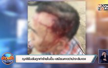 ญาติยืนยันถูกทำร้ายในปั๊ม-เสมียนคาดว่าน่าจะล้มเอง