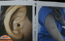 สอบพ่อเลี้ยงโหด ทำร้ายร่างกาย จุดไฟแช็คเผาลิ้นลูกเลี้ยง 