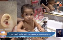 “ป๊อก-มาร์กี้” ตกใจ “มีก้า” เลือดออกหู รีบพาพบแพทย์ด่วน
