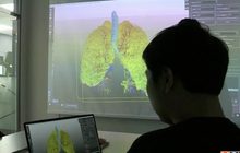 เทคโนโลยี 3D ช่วยแพทย์วางแผนผ่าตัด