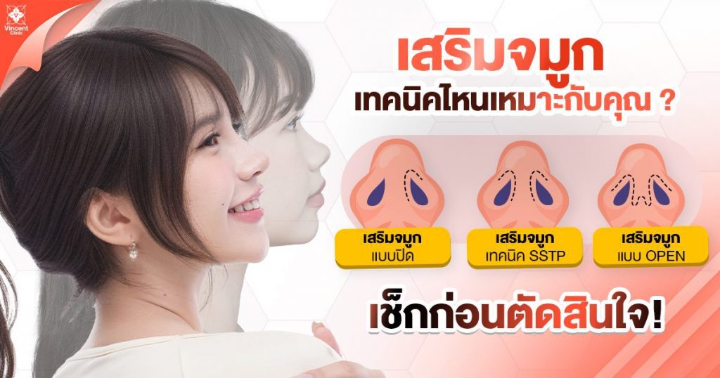 เสริมจมูก มีกี่เทคนิค?