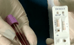CDC ของสหรัฐฯ ตรวจสอบการเผยแพร่ของไวรัส ZIKA