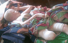 การล่าคนผิวเผือกในแทนซาเนีย