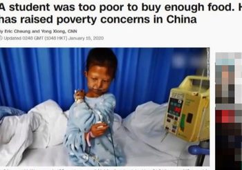 นักศึกษาจีน อดข้าวเก็บเงินรักษาน้อง-ขาดสารอาหารเสียชีวิต