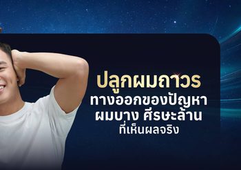 ปลูกผมถาวรคืออะไร? รวมทุกเรื่องที่ควรรู้ก่อนตัดสินใจปลูกผม