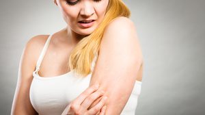 ตอบคำถามให้หายข้องใจ ผิวแห้งในหน้าหนาวแบบนี้ ดูแลยังไงดีคะซิส?