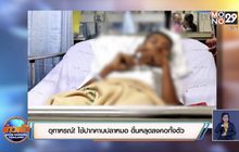 อุทาหรณ์! ใช้ปากคาบปลาหมอ ดิ้นหลุดลงคอทั้งตัว