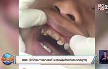 สสส. จัดโครงการรณรงค์ แปรงฟันป้องกันอนาคตลูกผุ