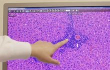 “โมเดอร์น่า” โชว์ความสำเร็จทดสอบวัคซีนระยะแรก