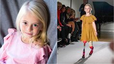 พิการอย่าได้แคร์! สาวน้อย 7 ขวบไร้ขา เป็นนางแบบเสื้อผ้าเด็กแบรนด์ดัง