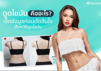 ดูดไขมัน (Liposuction) คืออะไร? ออกแบบหุ่นให้สวยได้จริงไหม