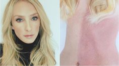 Taylor Muhl นางแบบผิวสองสี ที่เกิดจากการรวมร่างน้องสาวฝาแฝดตั้งแต่ในครรภ์!!