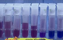 ยอดผู้เสียชีวิตจากไวรัสโคโรนาในจีนพุ่งเกือบ 500 ราย