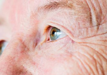 รู้จัก “ต้อหิน” ภัยร้ายใกล้ตัวที่อาจพรากการมองเห็นของคุณไปตลอดกาล