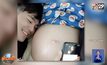 “บีม กวี” แย้มชื่อลูกแฝด หวั่นภรรยาคลอดก่อนกำหนด