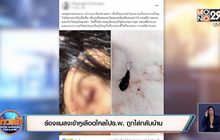 ร้องแมลงเข้าหูเลือดไหลไป ร.พ. ถูกไล่กลับบ้าน