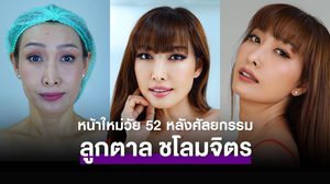 ลูกตาล ชโลมจิต หลังดึงหน้าในวัย 52 สวยกระชากวัย ฮอตกว่าตอนเข้าวงการใหม่ๆ