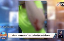 เร่งตรวจสอบวงจรปิดเหตุทำร้ายร่างกายนักวิ่งสาว