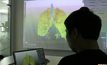 เทคโนโลยี 3D ช่วยแพทย์วางแผนผ่าตัด