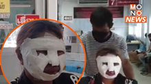 แม่ค้าท้อง 3 เดือน ถูกลูกฟุตบอลตกใส่กระทะน้ำมันลวกหน้า