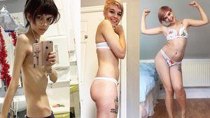 สตรองไม่แพ้ใคร! สาวเปิดประสบการณ์เอาชนะ โรคคลั่งผอม สร้างแรงบันดาลใจให้มั่นใจในตัวเอง