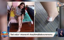 “ไอซ์ อามีนา” ฟาดเคราะห์! เกิดอุบัติเหตุลื่นล้มจนกระทบงาน