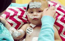 เปลี่ยนถ่ายตับช่วยชีวิตทารกวัย 11 เดือน