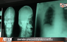 แพทย์ระบุหลวงตาจันทร์อาการดีขึ้น