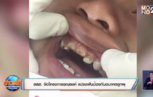 สสส. จัดโครงการรณรงค์ แปรงฟันป้องกันอนาคตลูกผุ