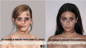 สาวฮอลลีวู้ด เผยภาพ โดนซ้อม จนหน้าน่วม ในโปรเจค ยุติความรุนแรงในผู้หญิง